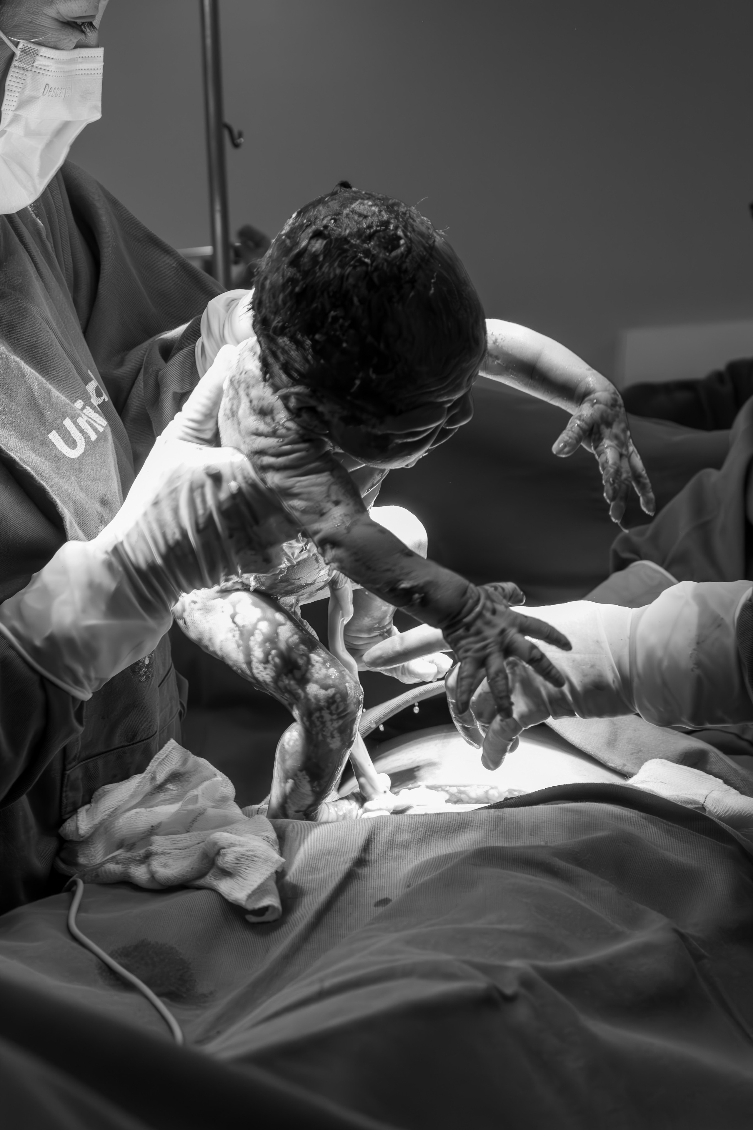 Contato. Fotografia de Parto em Poços de Caldas|Registro de Parto
