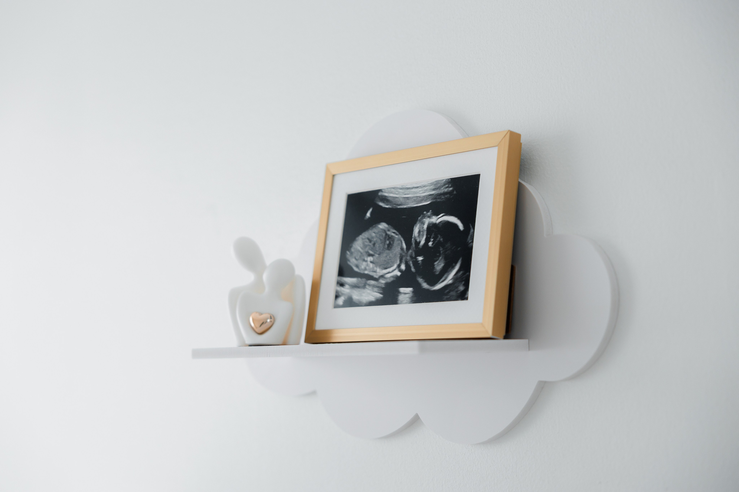 New born. Photographer Elvira Hryshchenko