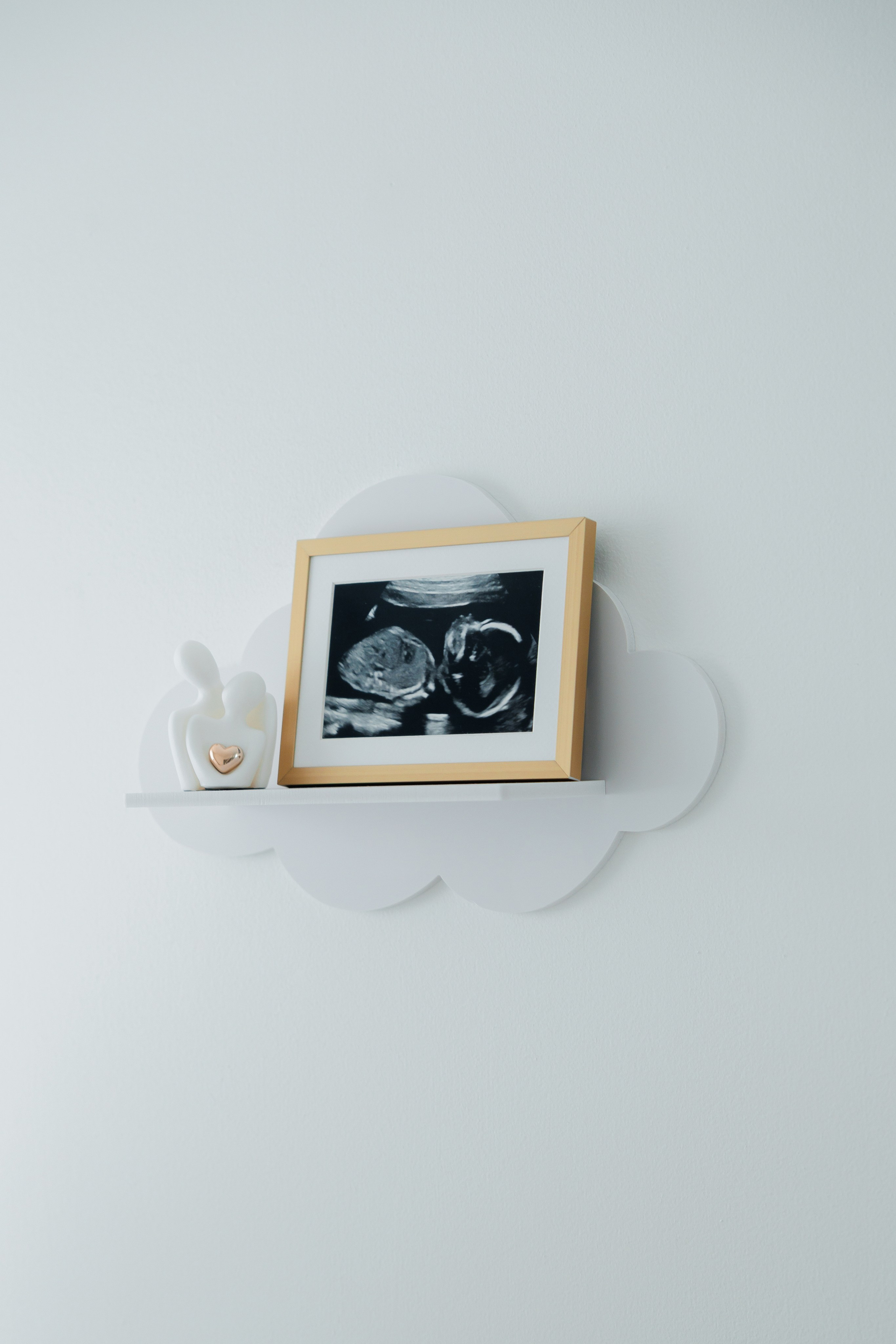 New born. Photographer Elvira Hryshchenko
