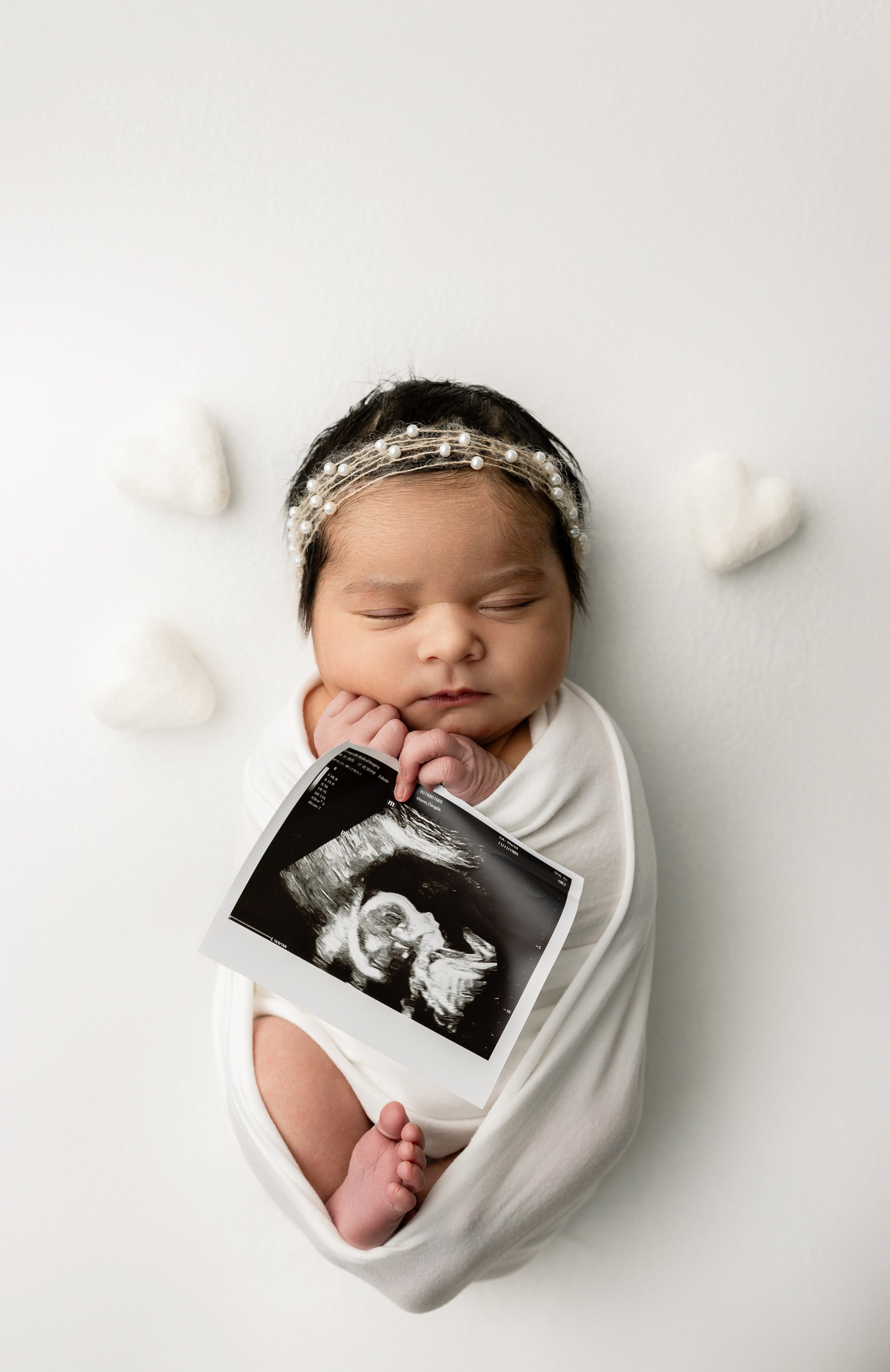 5–20 Days Newborn Photography in Toronto. Iana Banana | Toronto Maternity, Newborn & Family Photographer