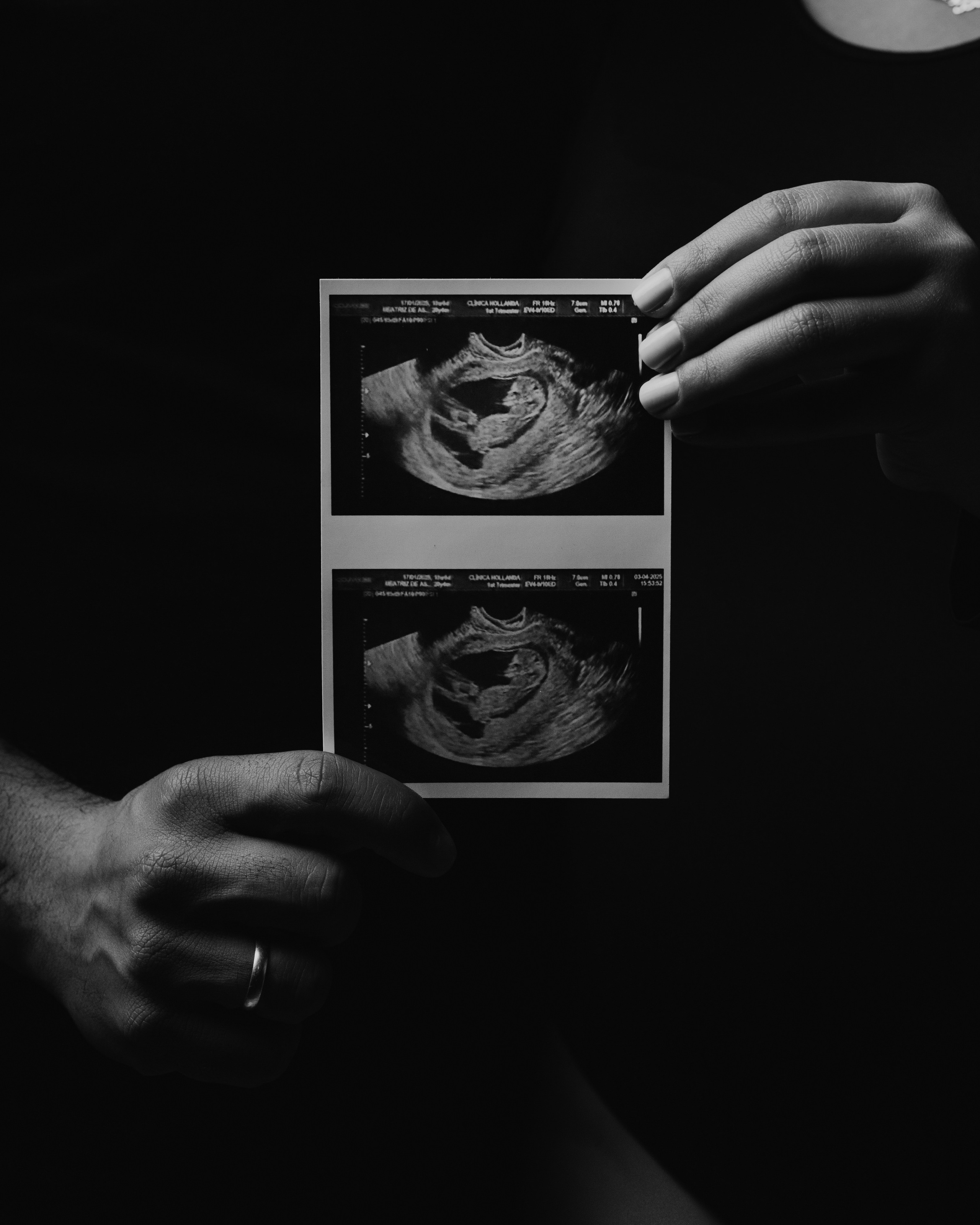2025 | Beatriz — Gestante — Estudio. Denis Damasceno | Fotografia