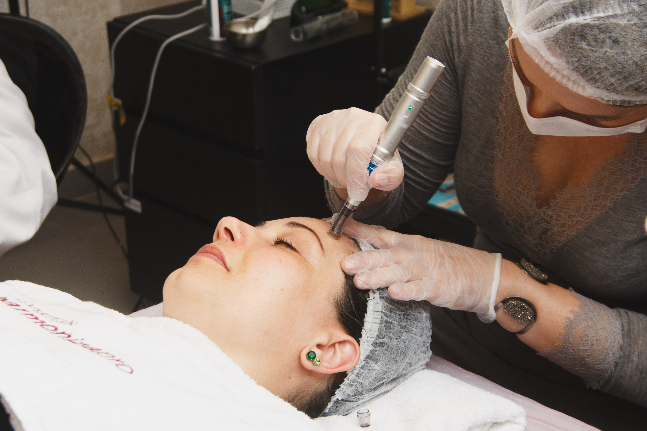Microagulhamento Biológico (Peeling Coreano): conhecimento, técnica e prática profissional na La Vertuan em Joinville. Marcus Monteiro Fotografia