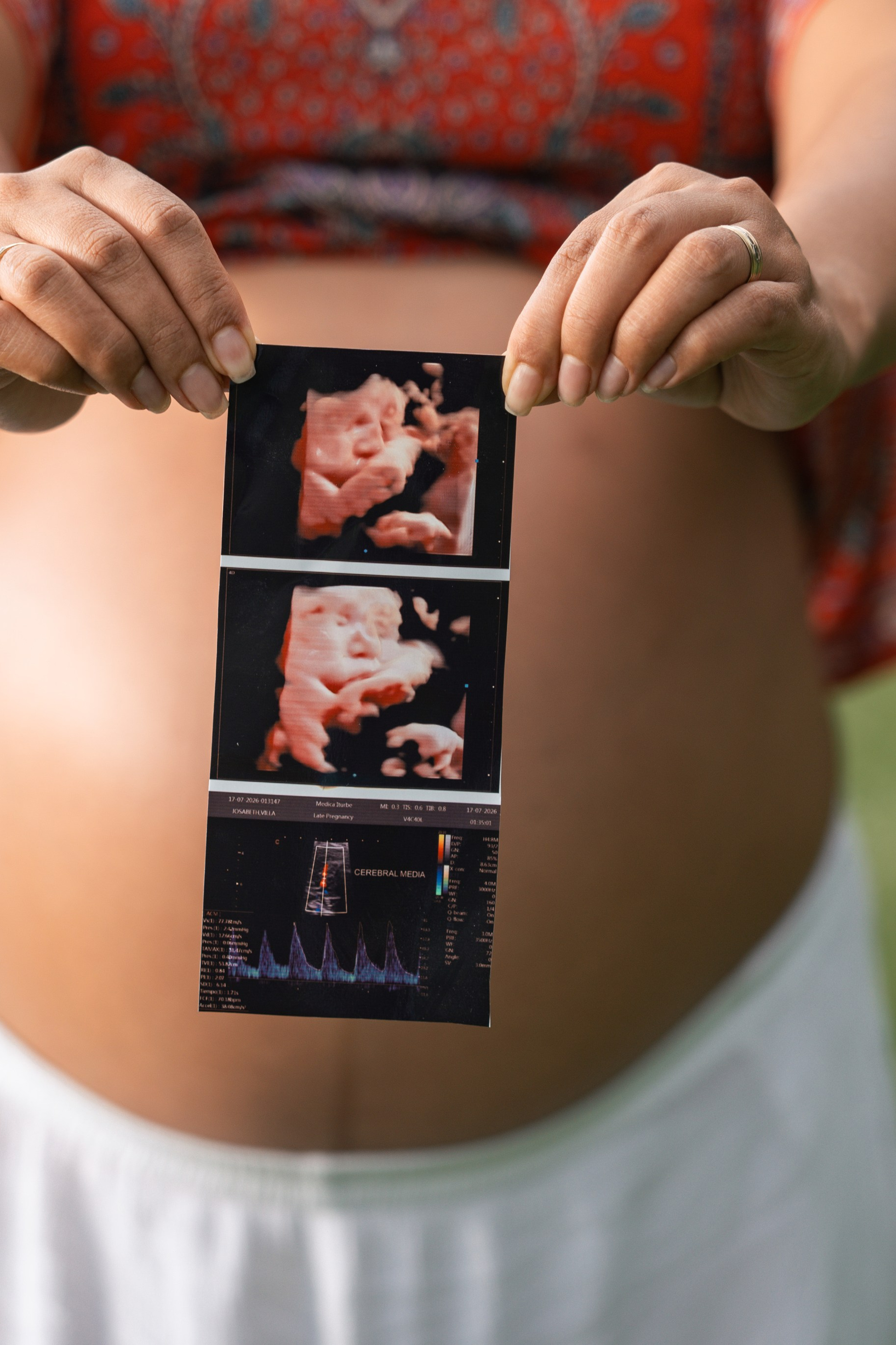 Maternidad
